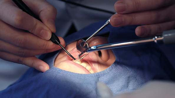 Pre-veneer Gum Health Enhancement