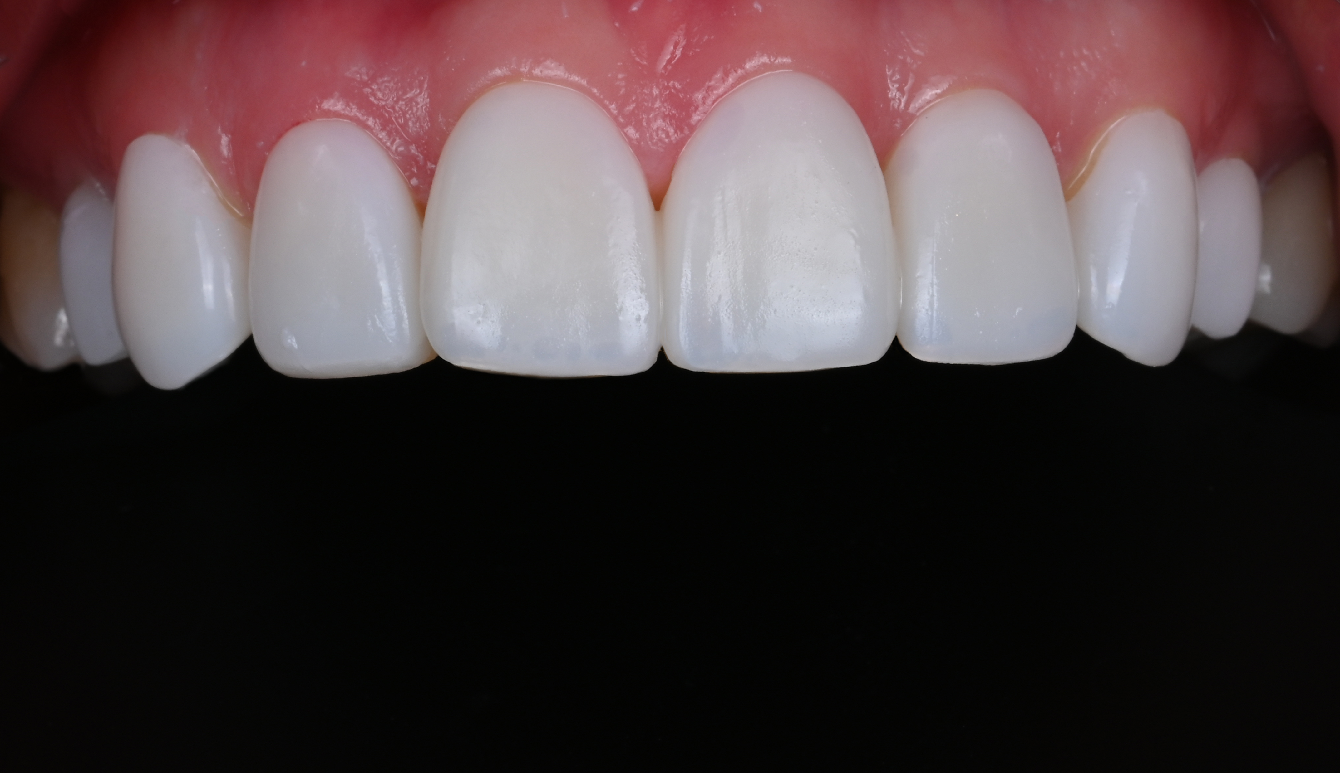 Make Dental case 4 after