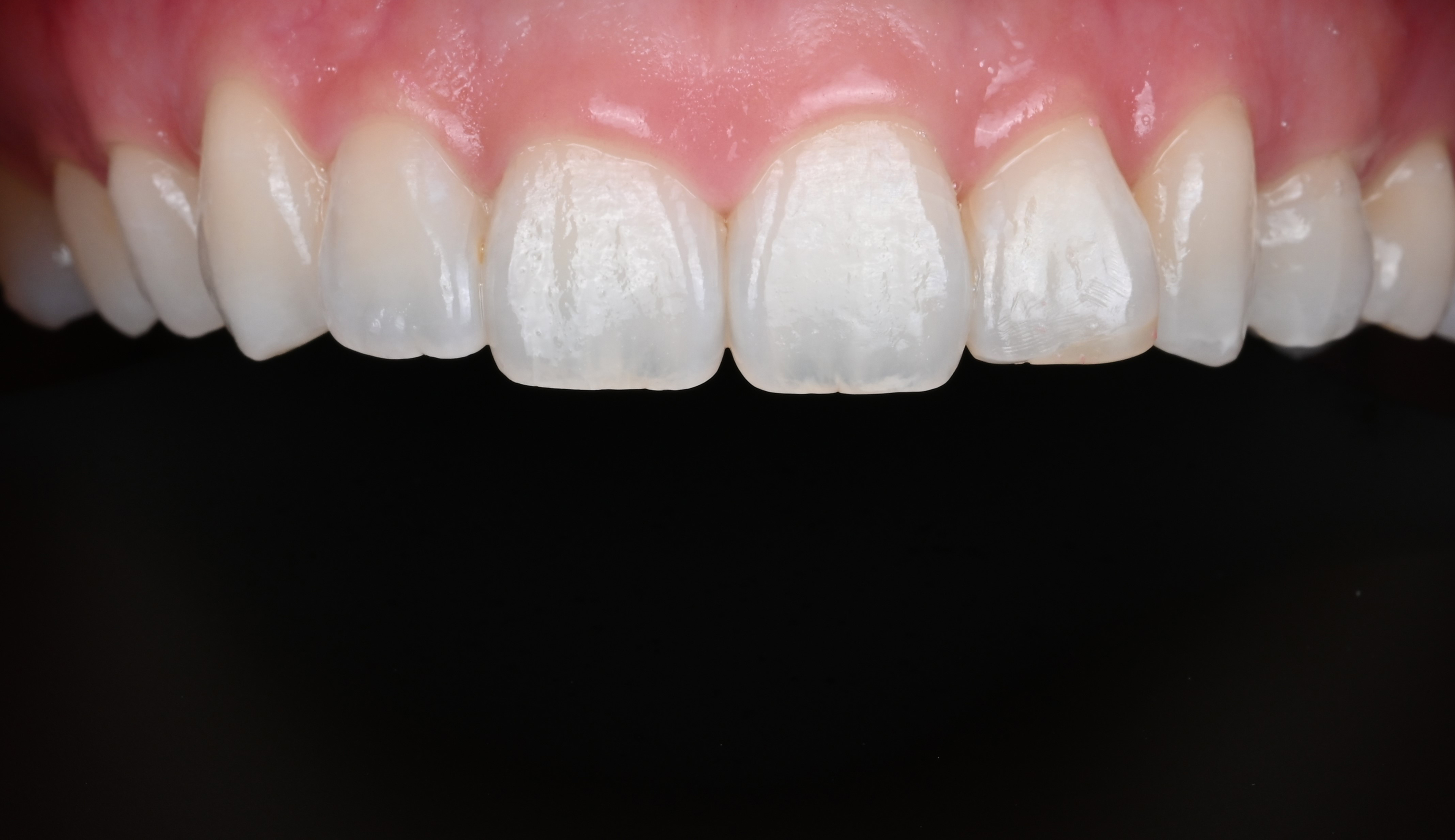 Make Dental case 8 after