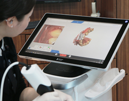 3D Scan