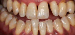 Dual Make Dental Before/After