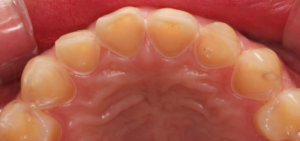 Dual Make Dental Before/After