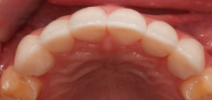 Dual Make Dental Before/After