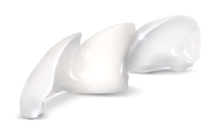 Bridge Make Dental Before/After